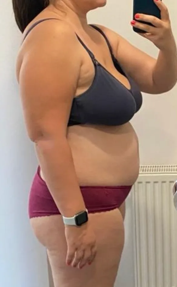 Andreea D., înainte de programul NEW BODY