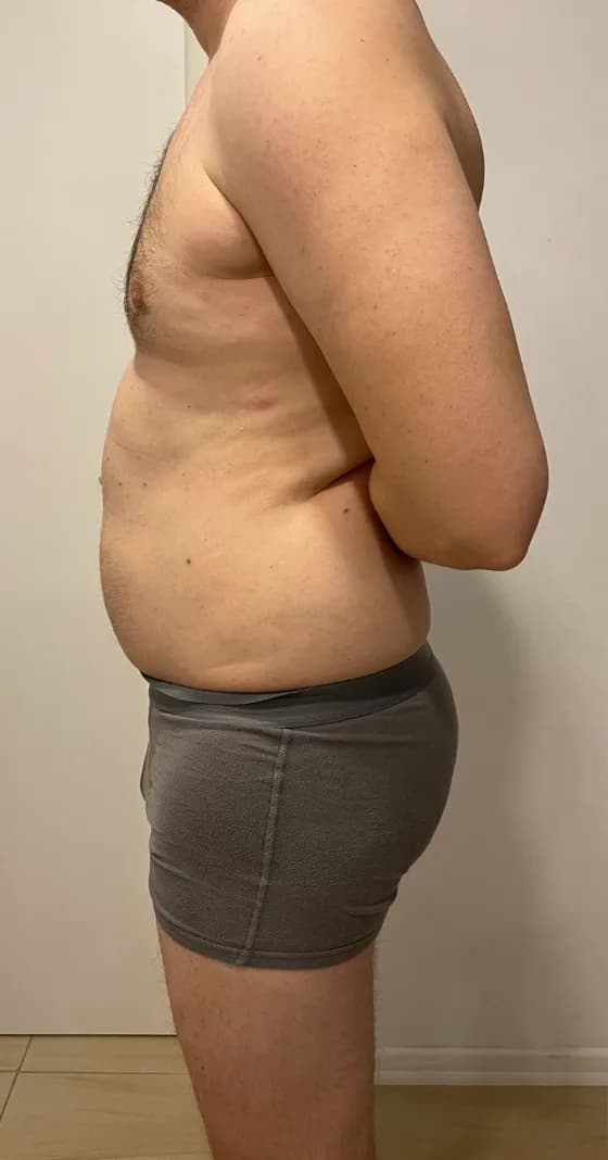 Louis, înainte de programul NEW BODY