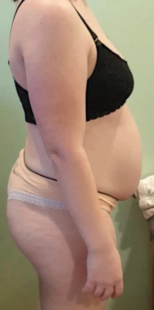 Nicoleta, înainte de programul NEW BODY